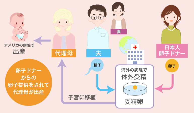 モンドメディカル-代理出産プログラムの仕組み